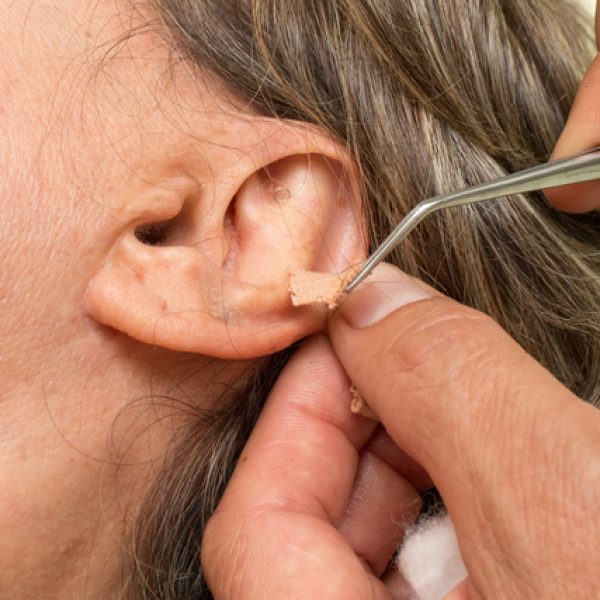 BeautiSeed™ - Stress Relief Acupressure Bud