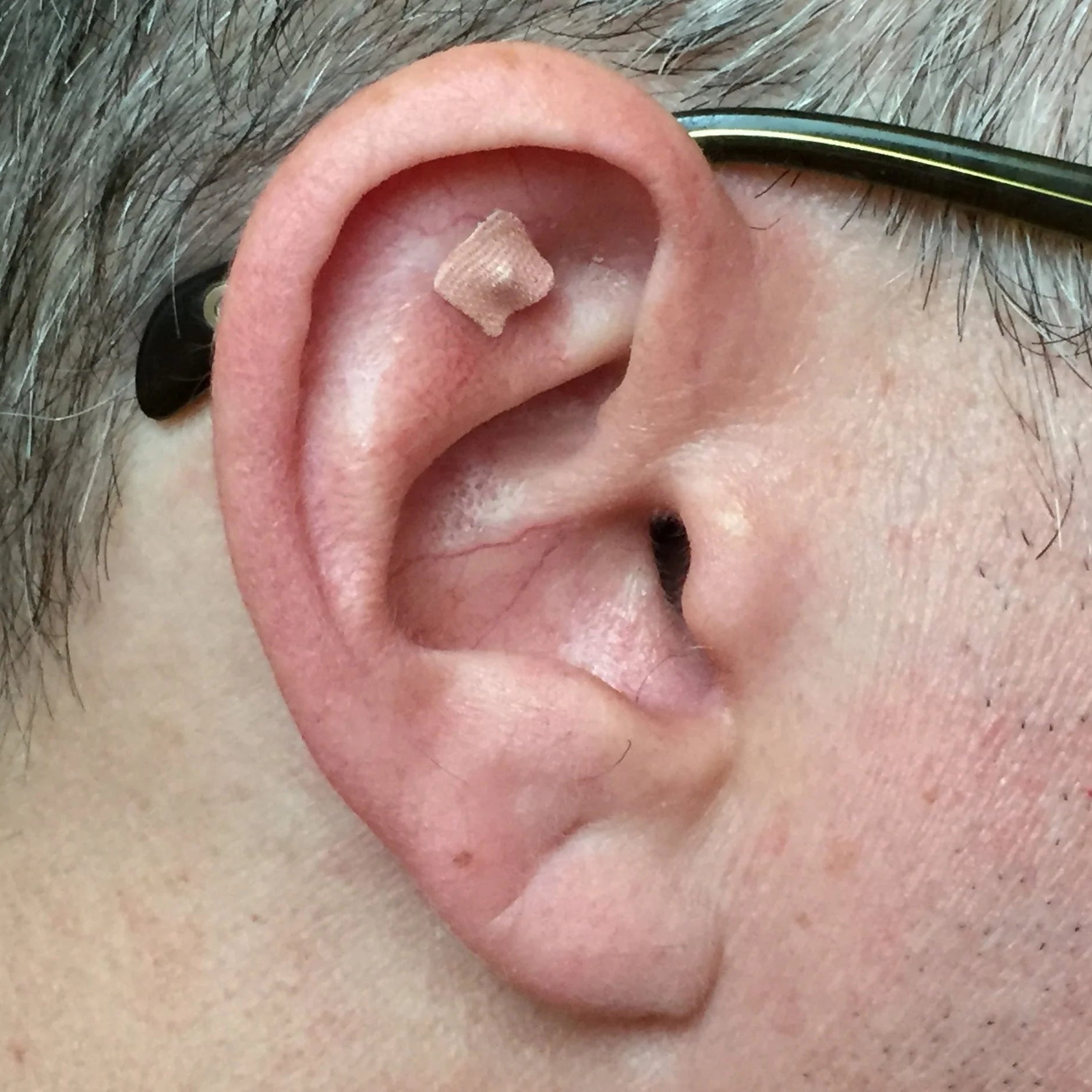 BeautiSeed™ - Stress Relief Acupressure Bud